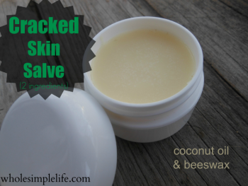 Cracked Skin Salve | http://www.wholesimplelife.com #diyskinsalve #coconutoil #beeswax